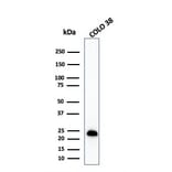 Western Blot - Anti-MelanA Antibody [MLANA/1409R] (A248567) - Antibodies.com