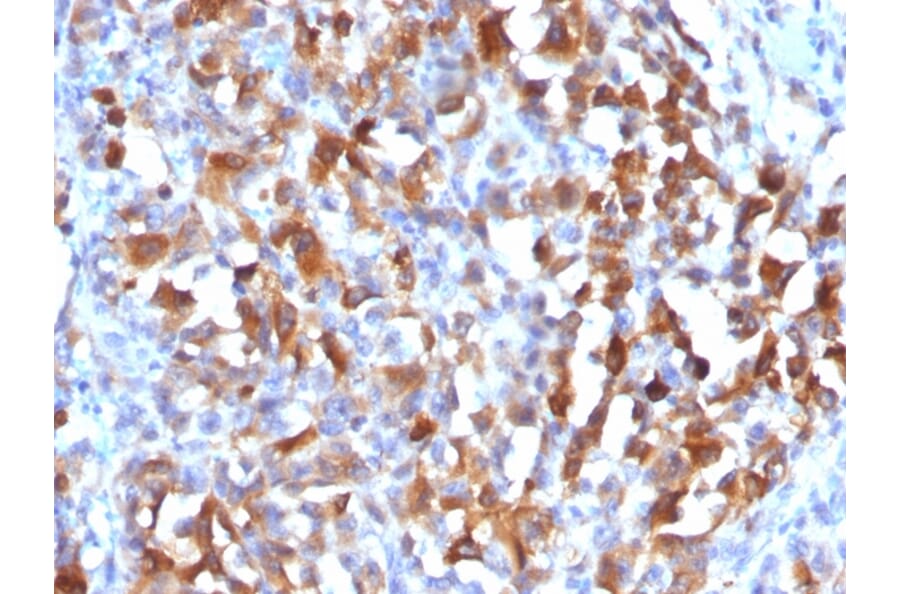Immunohistochemistry - Anti-MelanA Antibody (A248567) - Antibodies.com