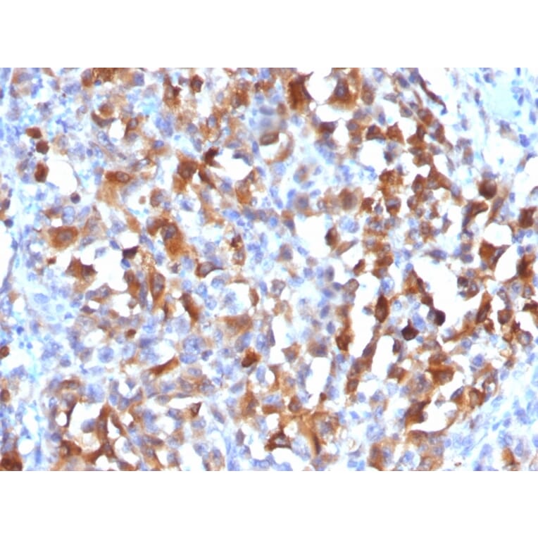 Immunohistochemistry - Anti-MelanA Antibody (A248567) - Antibodies.com