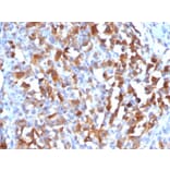 Immunohistochemistry - Anti-MelanA Antibody (A248567) - Antibodies.com