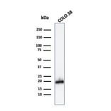 Western Blot - Anti-MelanA Antibody (A248568) - Antibodies.com