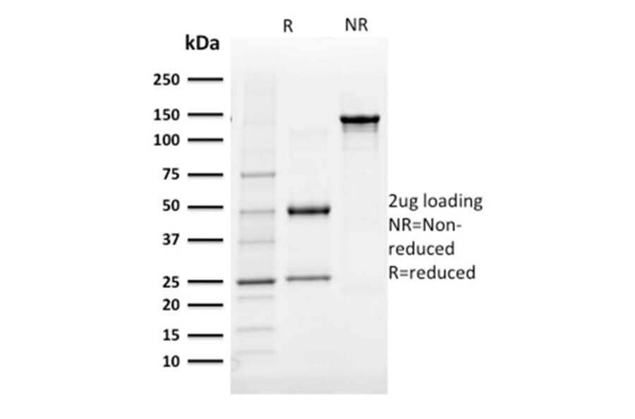 SDS-PAGE - Anti-AKR1B1 Antibody [CPTC-AKR1B1-3] (A248569) - Antibodies.com