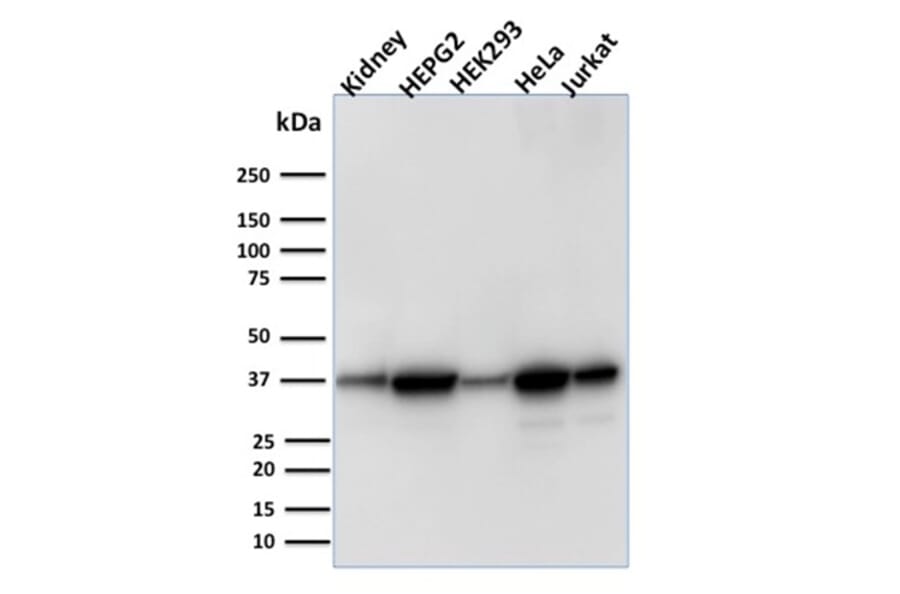 Western Blot - Anti-AKR1B1 Antibody [CPTC-AKR1B1-3] (A248569) - Antibodies.com