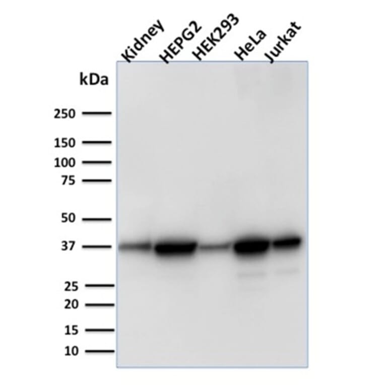 Western Blot - Anti-AKR1B1 Antibody [CPTC-AKR1B1-3] (A248569) - Antibodies.com