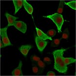 Immunofluorescence - Anti-AKR1B1 Antibody [CPTC-AKR1B1-3] (A248569) - Antibodies.com