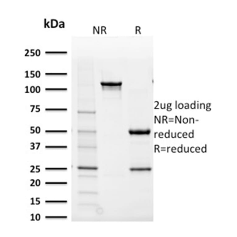 SDS-PAGE - Anti-AKR1B1 Antibody [CPTC-AKR1B1-2] (A248570) - Antibodies.com