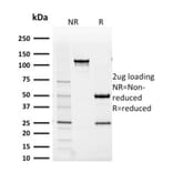 SDS-PAGE - Anti-AKR1B1 Antibody [CPTC-AKR1B1-2] (A248570) - Antibodies.com