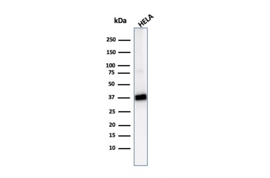 Western Blot - Anti-AKR1B1 Antibody [CPTC-AKR1B1-2] (A248570) - Antibodies.com