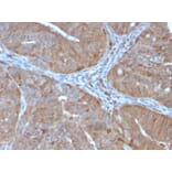 Immunohistochemistry - Anti-AKR1B1 Antibody [CPTC-AKR1B1-2] (A248570) - Antibodies.com