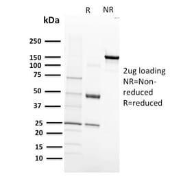 SDS-PAGE - Anti-VEGF Receptor 1 Antibody [FLT1/658] (A248570) - Antibodies.com