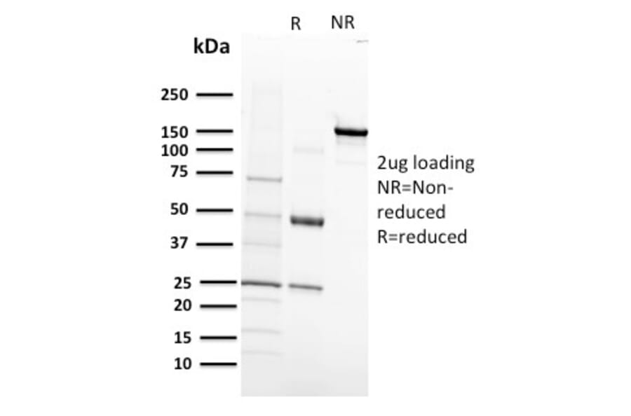 SDS-PAGE - Anti-VEGF Receptor 1 Antibody [FLT1/658] (A248570) - Antibodies.com