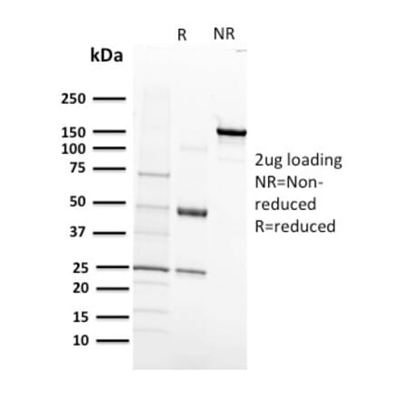 SDS-PAGE - Anti-VEGF Receptor 1 Antibody [FLT1/658] (A248570) - Antibodies.com