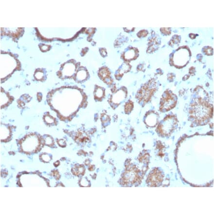 Immunohistochemistry - Anti-DBC2 Antibody [DBC2/3362] (A248572) - Antibodies.com