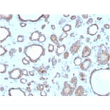 Immunohistochemistry - Anti-DBC2 Antibody [DBC2/3362] (A248572) - Antibodies.com