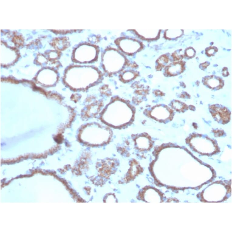 Immunohistochemistry - Anti-DBC2 Antibody [DBC2/3362] (A248572) - Antibodies.com
