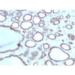 Immunohistochemistry - Anti-DBC2 Antibody [DBC2/3362] (A248572) - Antibodies.com
