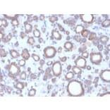 Immunohistochemistry - Anti-DBC2 Antibody [DBC2/3364] (A248573) - Antibodies.com