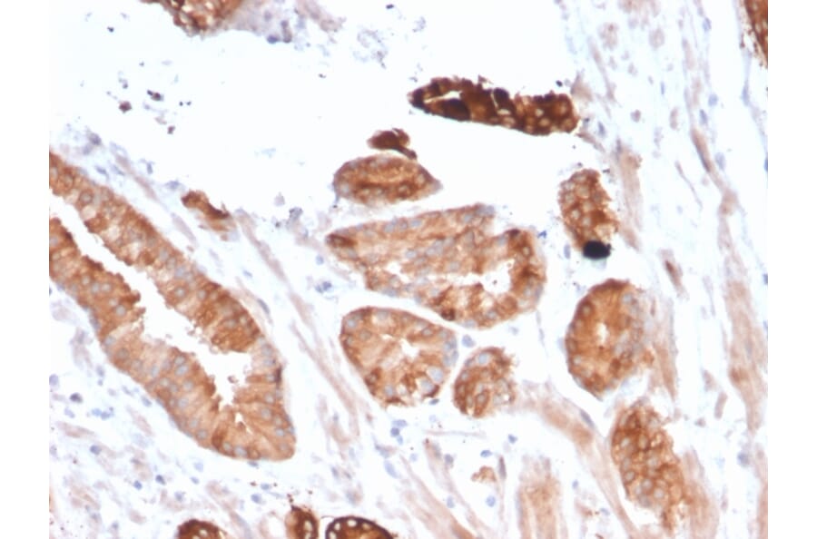 Immunohistochemistry - Anti-FLT3 Antibody [FLT3/2458] (A248573) - Antibodies.com