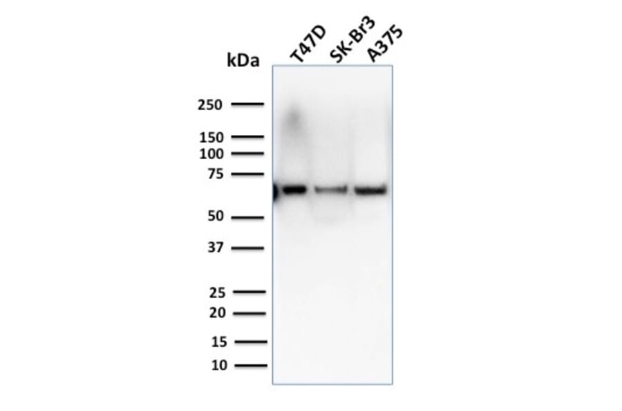 Western Blot - Anti-CSTF2T Antibody [PCRP-CSTF2T-1A3] (A248575) - Antibodies.com