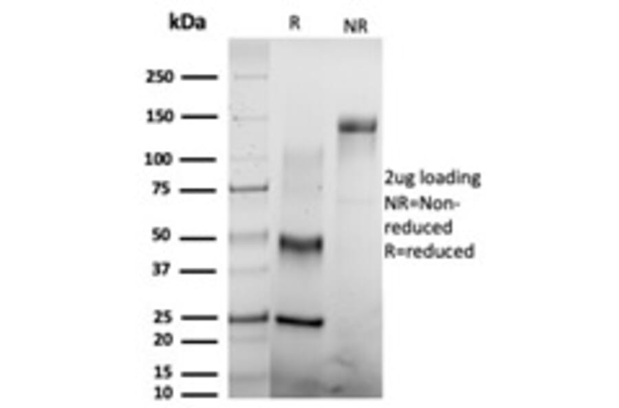 SDS-PAGE - Anti-CSTF2T Antibody [PCRP-CSTF2T-1A3] (A248575) - Antibodies.com