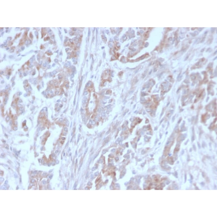 Immunohistochemistry - Anti-ICOS Ligand Antibody [ICOSL/3111] (A248576) - Antibodies.com