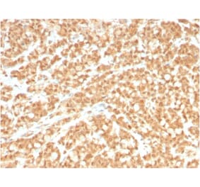 Immunohistochemistry - Anti-ICOS Ligand Antibody [ICOSL/3260] (A248577) - Antibodies.com