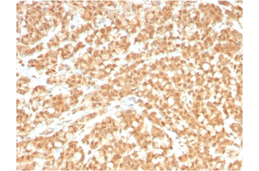 Immunohistochemistry - Anti-ICOS Ligand Antibody [ICOSL/3260] (A248577) - Antibodies.com