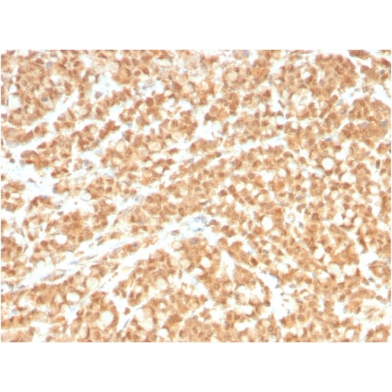 Immunohistochemistry - Anti-ICOS Ligand Antibody [ICOSL/3260] (A248577) - Antibodies.com