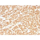 Immunohistochemistry - Anti-ICOS Ligand Antibody [ICOSL/3260] (A248577) - Antibodies.com