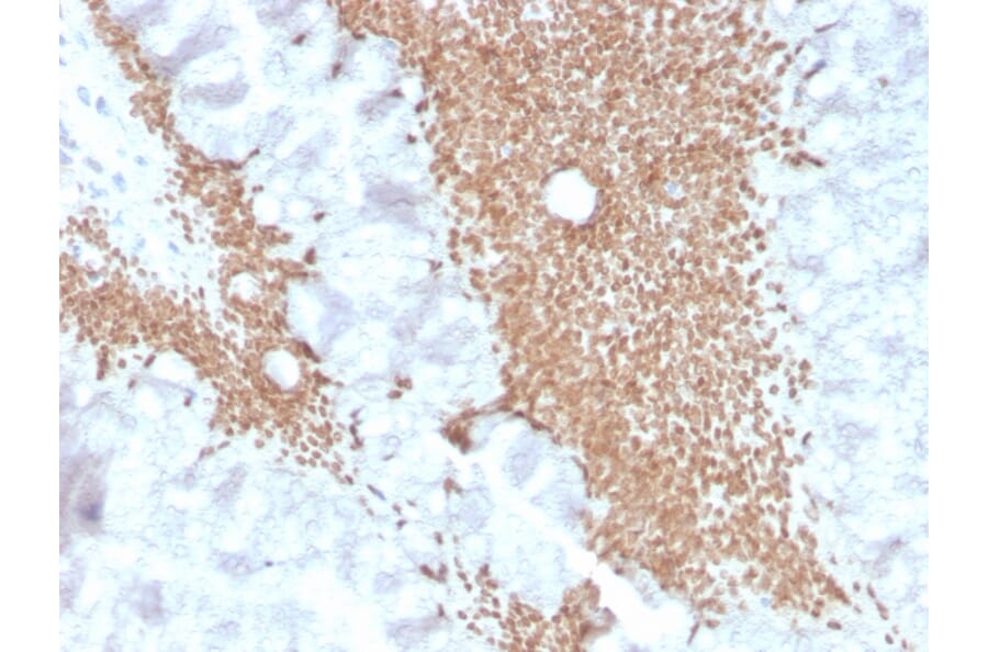 Immunohistochemistry - Anti-SATB2 Antibody [SATB2/4374R] (A248578) - Antibodies.com