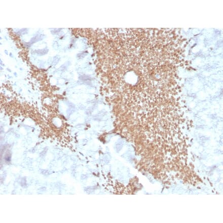 Immunohistochemistry - Anti-SATB2 Antibody [SATB2/4374R] (A248578) - Antibodies.com