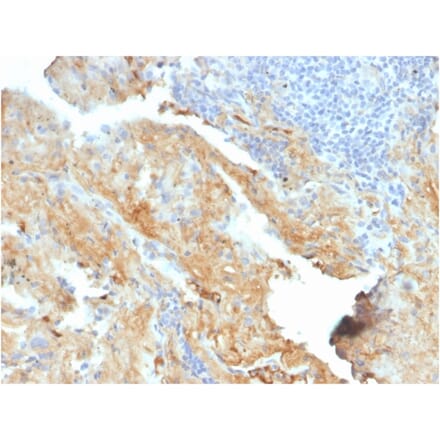Immunohistochemistry - Anti-Fibronectin Antibody [FN1/2950] (A248579) - Antibodies.com