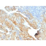 Immunohistochemistry - Anti-Fibronectin Antibody [FN1/2950] (A248579) - Antibodies.com