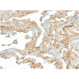 Immunohistochemistry - Anti-Fibronectin Antibody [FN1/2950] (A248579) - Antibodies.com