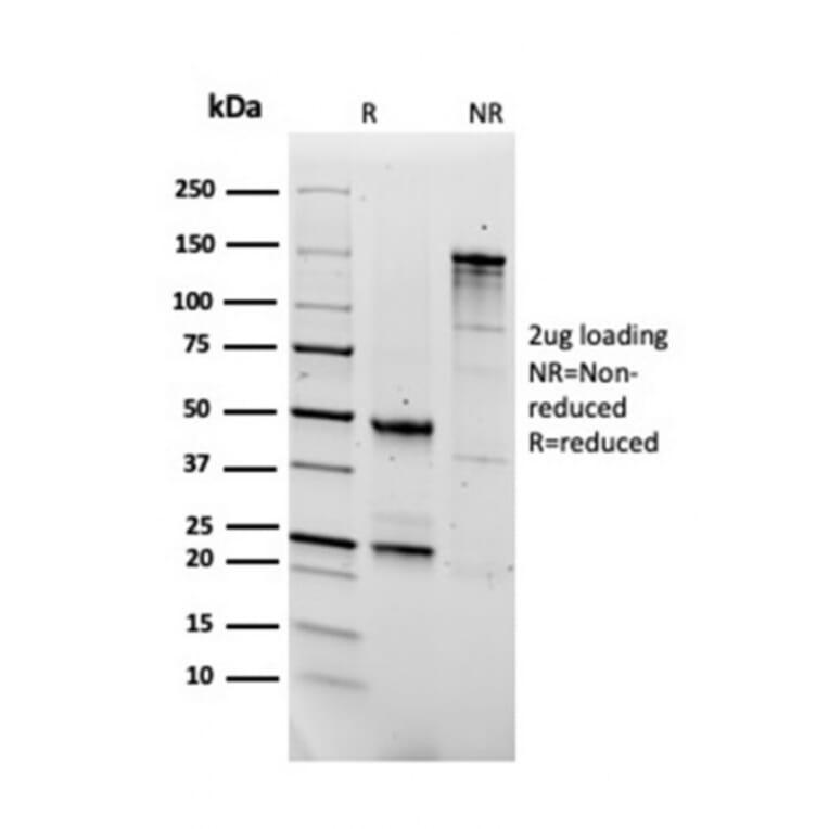 SDS-PAGE - Anti-Fibronectin Antibody [FN1/2950] (A248579) - Antibodies.com