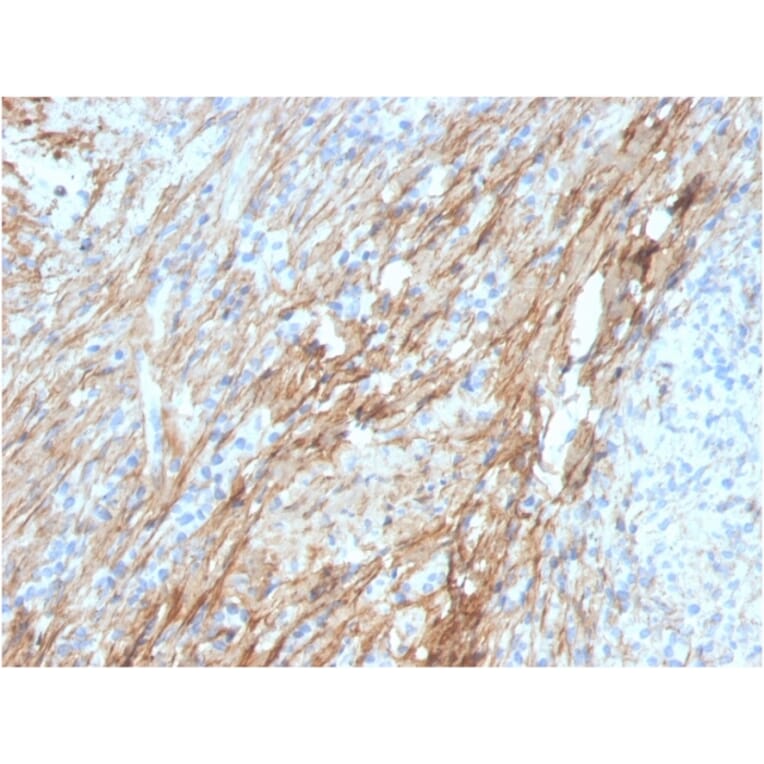Immunohistochemistry - Anti-Fibronectin Antibody [FN1/3029] (A248580) - Antibodies.com