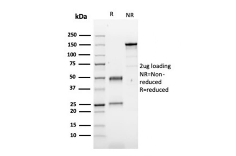 SDS-PAGE - Anti-Fibronectin Antibody [FN1/3029] (A248580) - Antibodies.com