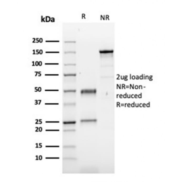 SDS-PAGE - Anti-Fibronectin Antibody [FN1/3029] (A248580) - Antibodies.com