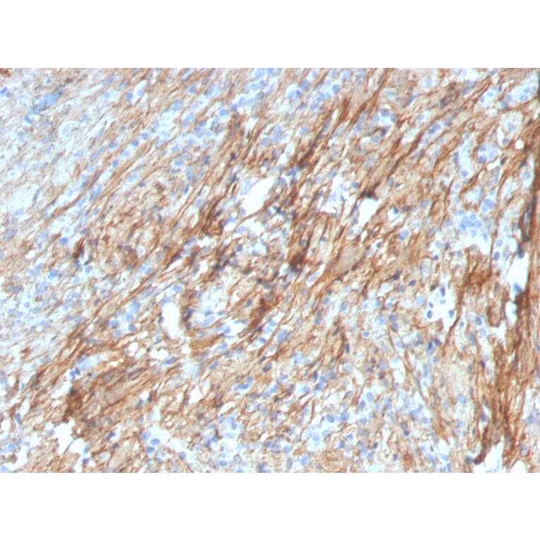 Immunohistochemistry - Anti-Fibronectin Antibody [FN1/3029] (A248580) - Antibodies.com