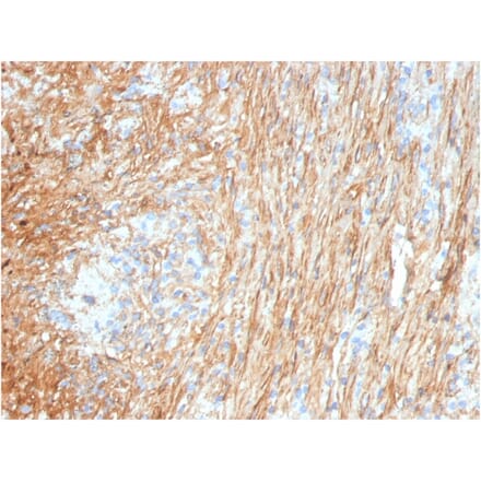 Immunohistochemistry - Anti-Fibronectin Antibody [FN1/3036] (A248581) - Antibodies.com