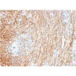 Immunohistochemistry - Anti-Fibronectin Antibody [FN1/3036] (A248581) - Antibodies.com