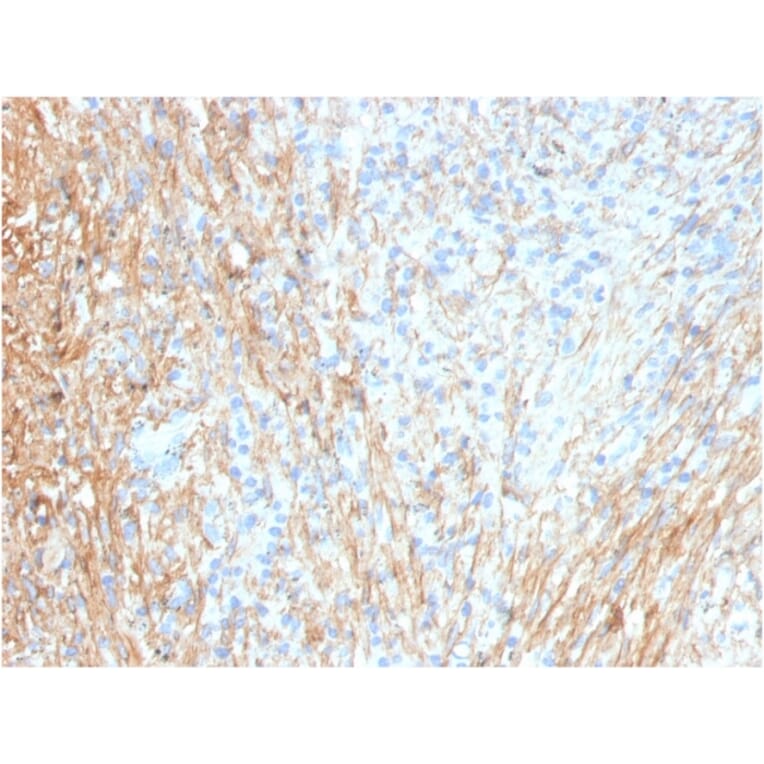 Immunohistochemistry - Anti-Fibronectin Antibody [FN1/3036] (A248581) - Antibodies.com
