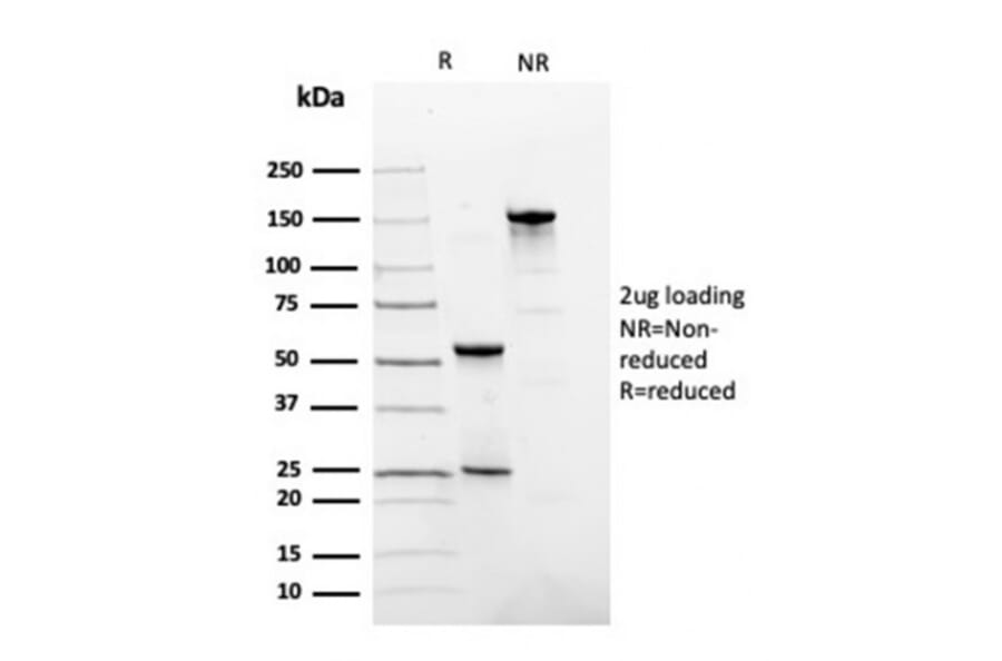SDS-PAGE - Anti-Fibronectin Antibody [FN1/3036] (A248581) - Antibodies.com