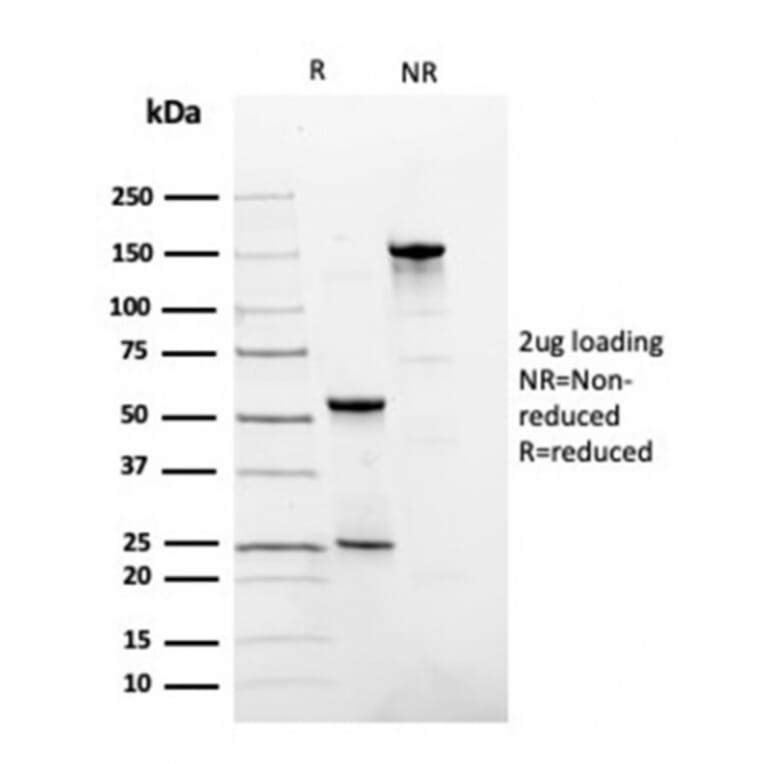 SDS-PAGE - Anti-Fibronectin Antibody [FN1/3036] (A248581) - Antibodies.com