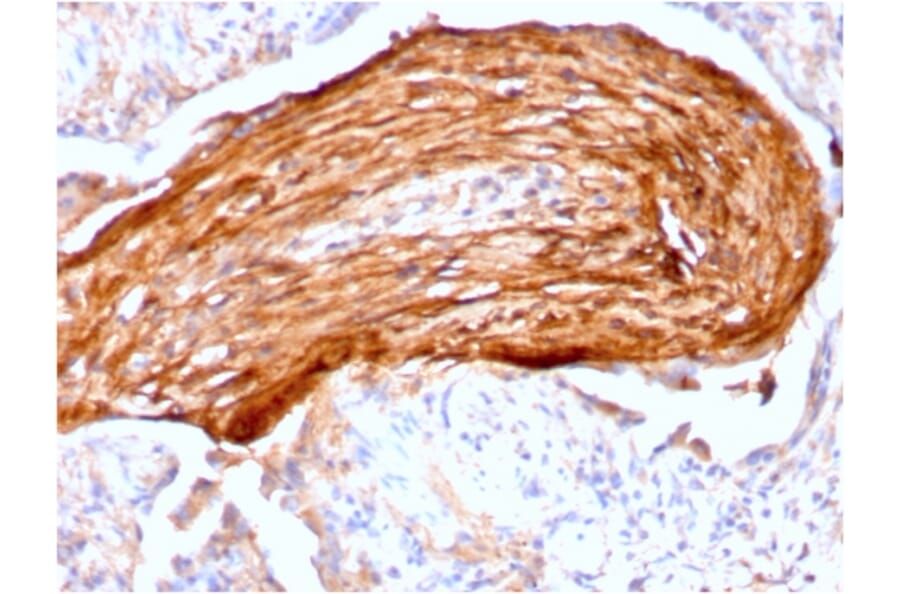 Immunohistochemistry - Anti-Fibronectin Antibody [FN1/3045] (A248582) - Antibodies.com
