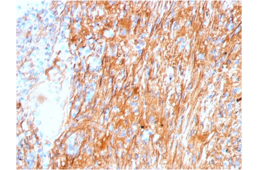 Immunohistochemistry - Anti-Fibronectin Antibody [FN1/3045] (A248582) - Antibodies.com