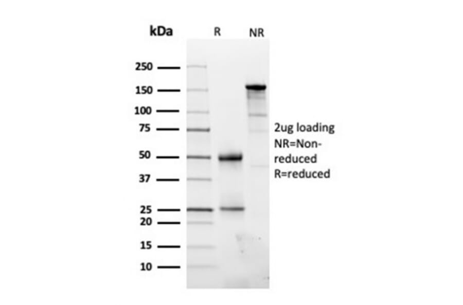 SDS-PAGE - Anti-Fibronectin Antibody [FN1/3045] (A248582) - Antibodies.com