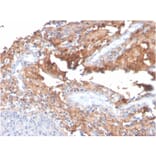 Immunohistochemistry - Anti-Fibronectin Antibody [C6F10] (A248583) - Antibodies.com