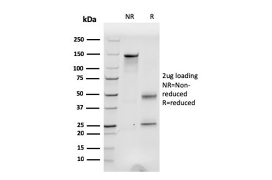 SDS-PAGE - Anti-Fibronectin Antibody [C6F10] (A248583) - Antibodies.com