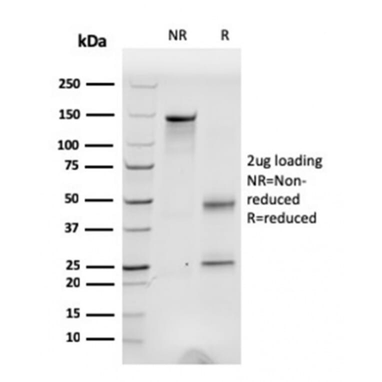 SDS-PAGE - Anti-Fibronectin Antibody [C6F10] (A248583) - Antibodies.com